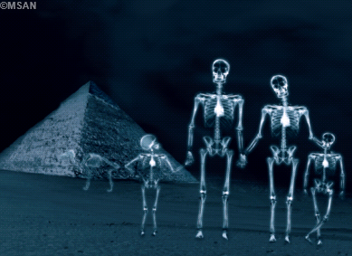 Campagne "Comment se débarrasser de ses vieilles radiographies argentiques?"